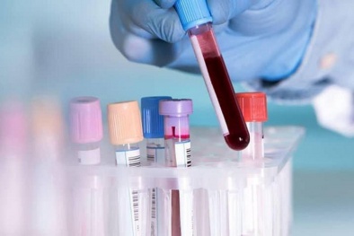 'Cuộc đua' chế tạo bộ kit test nhanh virus corona: Quốc gia nào đang nắm lợi thế?