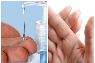 Dị ứng, hỏng da tay nếu dùng nước rửa tay khô kém chất lượng
