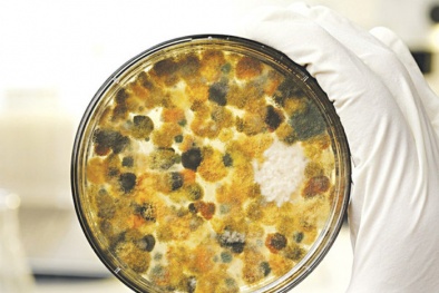 Nhận diện các 13Win OKVIP Cá cược bóng đá quen thuộc hàng ngày dễ chứa chất độc aflatoxin gây ung thư