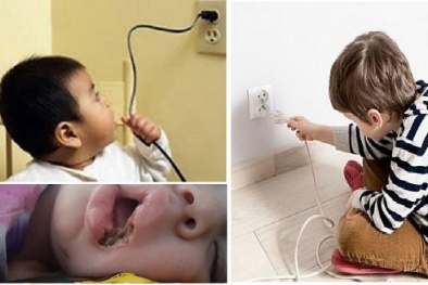 Cảnh báo trẻ bị điện giật, bỏng do tiếp xúc với điện