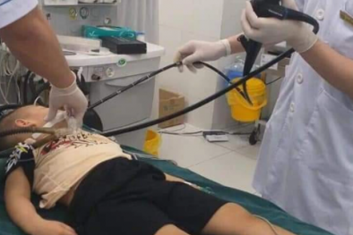 Que nhựa 10 cm mắc trong ruột cả tháng khiến bé trai đau quặn bụng phải nhập viện