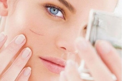 Tác hại khi dùng kem trị sẹo giả, kém chất lượng