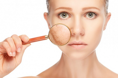 Trị nám không an toàn gây ra nhiều biến chứng nghiêm trọng