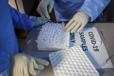 Virus SARS-CoV-2 đột biến 32 lần trong cơ thể một người từng nhiễm HIV