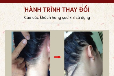 Bộ sản phẩm Da liễu mập mờ tiêu chuẩn chất lượng vẫn quảng cáo ‘ngập’ chợ mạng
