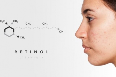 Cẩn trọng với các sản phẩm chăm sóc da có chứa retinol