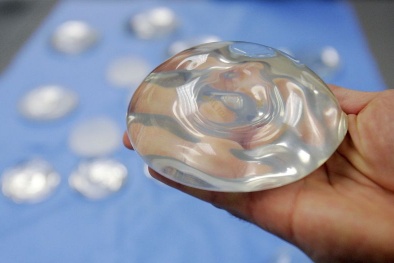 FDA cảnh báo về nâng ngực: Nhiều rủi ro tiềm ẩn, bao gồm cả loại bệnh ung thư hiếm gặp