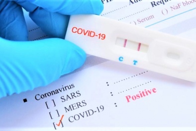Không được bảo quản và sử dụng đúng, kit test nhanh COVID-19 có thể gây hại 