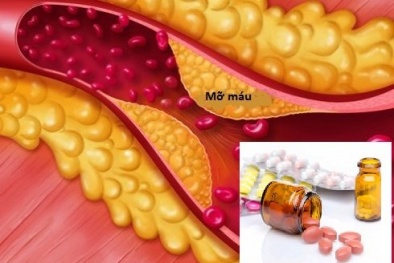 Bộ Y tế thu hồi 4 loại thuốc chứa hoạt chất chống chỉ định với người châu Á