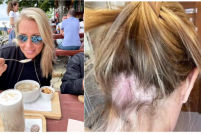 Sản phẩm chăm sóc tóc của Olaplex bị nghi có chứa thành phần gây hói
