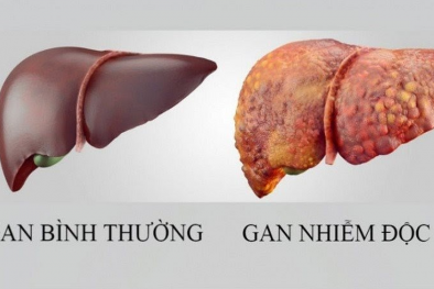 Nguy cơ từ phương pháp giải độc gan bằng 13Win OKVIP Cá cược bóng đá chức năng