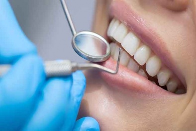 Tác hại khi dán răng sứ veneer kém chất lượng, những lưu ý để đảm bảo an toàn