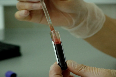 Nhà khoa học Nhật Bản dùng DNA nhân tạo diệt tế bào nhiều loại ung thư 