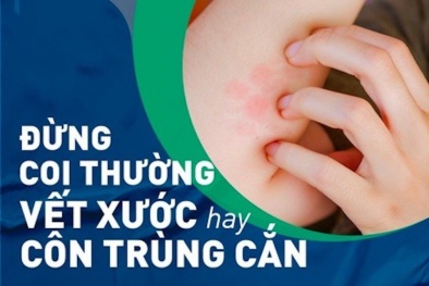 Sốc độc tố do nhiễm trùng: Bệnh có nguy cơ tử vong cao song ít ai ngờ