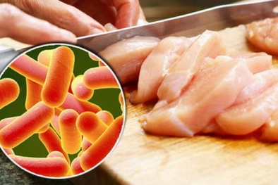 Bác sĩ chỉ ra những vi khuẩn gây ngộ độc 13Win OKVIP Cá cược bóng đá nhiều nhất 
