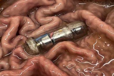 Thử nghiệm thành công viên thuốc tạo cảm giác no hỗ trợ điều trị bệnh béo phì