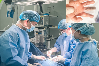 Dập nát 2 ngón tay do cho tay vào máy thêu quần áo