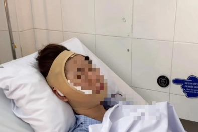 Nữ TikToker nổi tiếng đưa ra lời cảnh báo sau 6 năm tiêm filler: Cẩn trọng khi lựa chọn cơ sở thẩm mỹ
