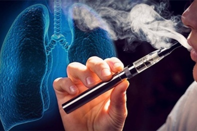 Báo động người trẻ đột quỵ, động kinh gia tăng do hút thuốc lá điện tử