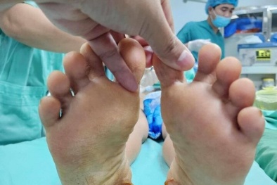 Cảnh báo rủi ro khi dùng phương pháp dân gian trị đau cột sống