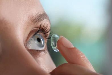 Người phụ nữ bị mù mắt do đeo kính áp tròng nhiều năm: Khuyến cáo từ chuyên gia