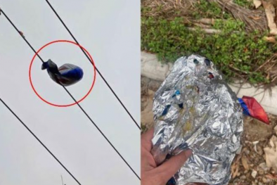 Bỏng nặng khuôn mặt do bóng bay bơm khí hydro bốc cháy ở tiệc sinh nhật 