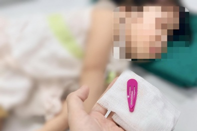Bé gái nuốt kẹp tóc: Tai nạn chỉ trong tích tắc